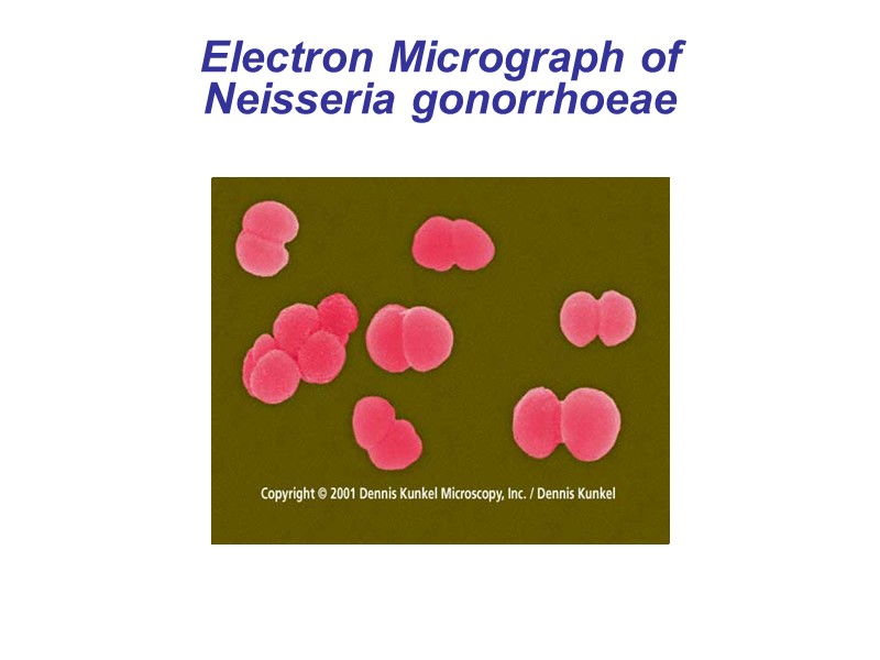 Electron Micrograph of  Neisseria gonorrhoeae